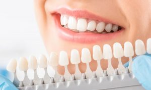 مزایا و معایب بلچینگ دندان