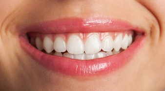  اصلاح به هم ریختگی دندان