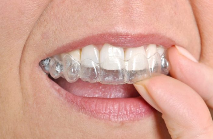 ارتودنسی متحرک دندان در کرج