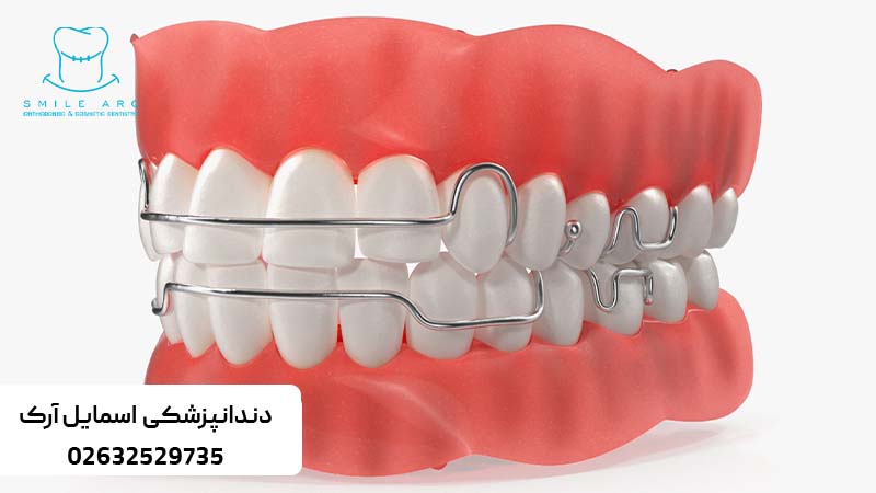 بهترین متخصص ارتودنسی کرج