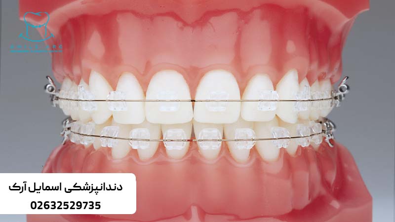 بهترین متخصص ارتودنسی کرج