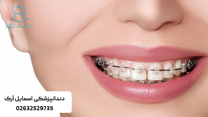 بهترین متخصص ارتودنسی کرج