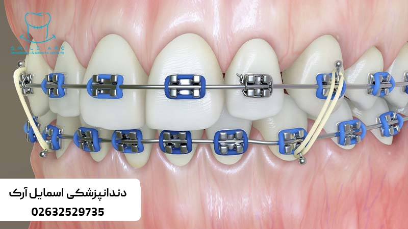 بهترین متخصص ارتودنسی کرج