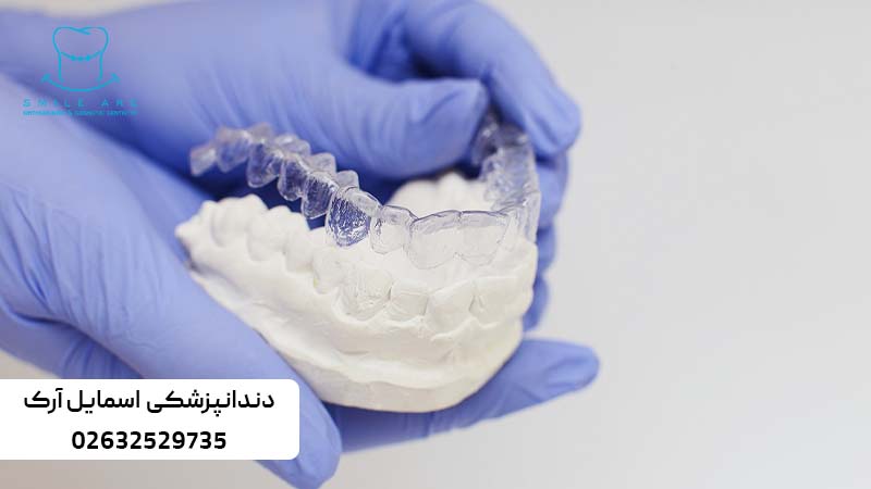 ارتودنسی دندان روکش شده