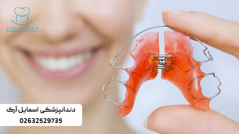 پلاک و نگهدارنده ثابت بعد از ارتودنسی