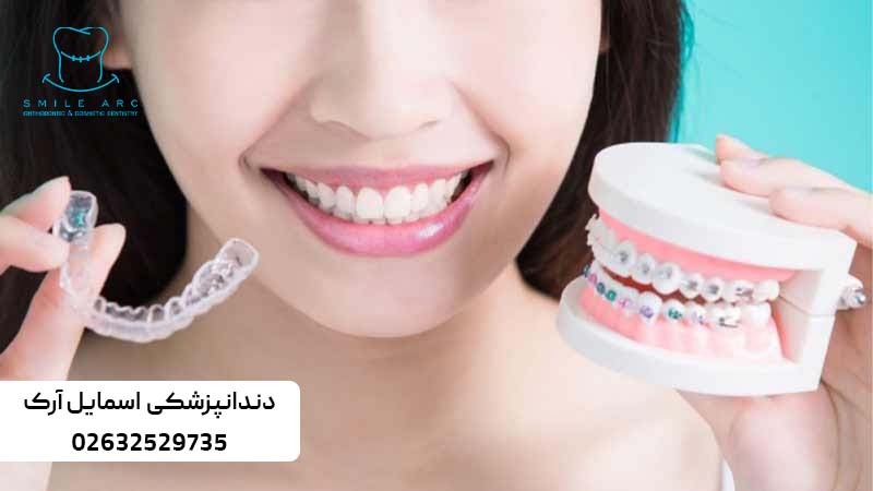 بهترین روش ارتودنسی