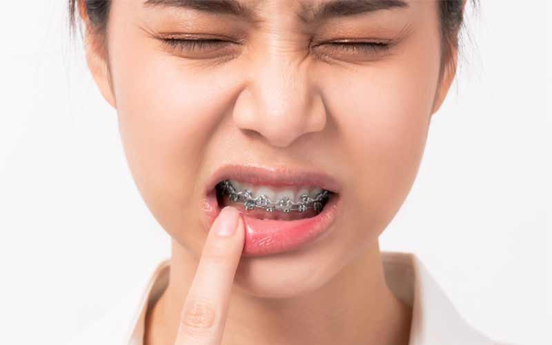 6-عوارض-انجام-ندان-ارتودنسی