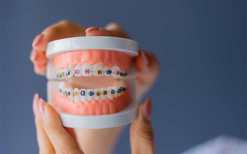 بهترین-سن-برای-ارتودنسی