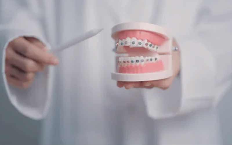 عوارض-ارتودنسی-اشتباه