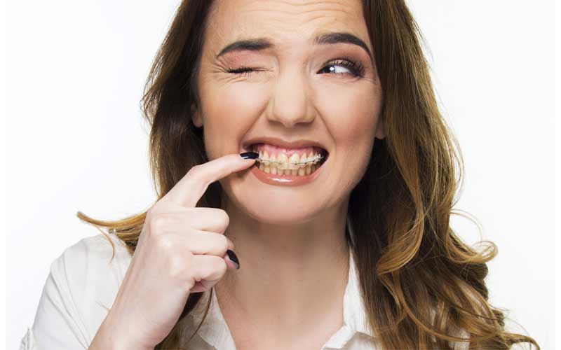 عوارض-ارتودنسی-نکردن-در-بزرگسالان