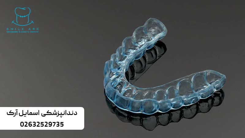 نایت گارد یا محافظ دندان چیست