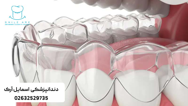 ارتودنسی نیم فک