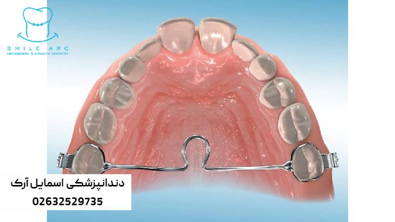 ارتودنسی ارزان در کرج