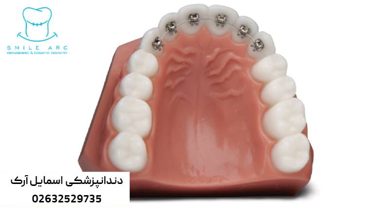 ارتودنسی ارزان در کرج