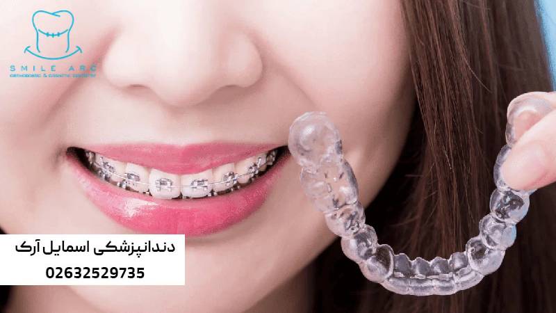 ارتودنسی ارزان در کرج