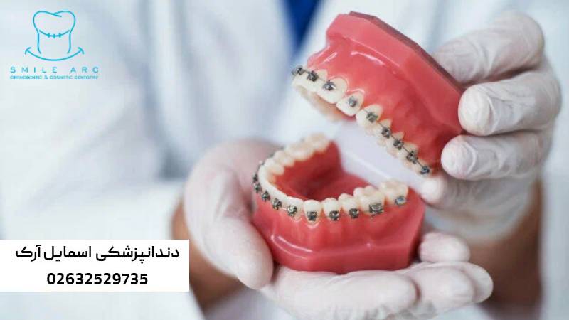 ارتودنسی ارزان در کرج