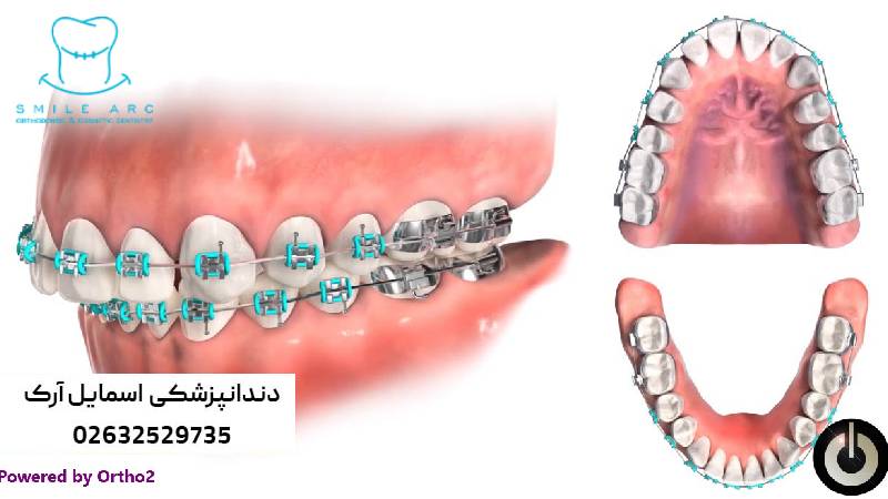 ارتودنسی ارزان در کرج