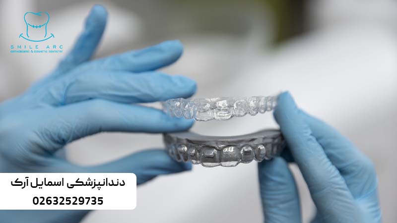 زمان استفاده از الاینر ارتودنسی