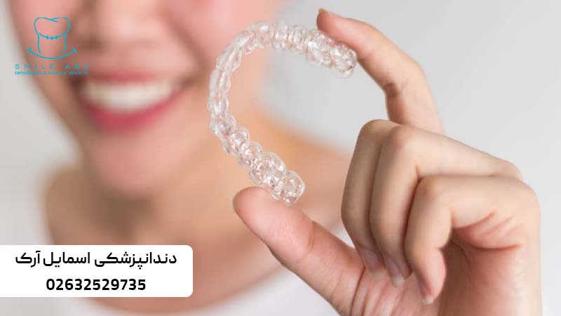 زمان استفاده از الاینر ارتودنسی