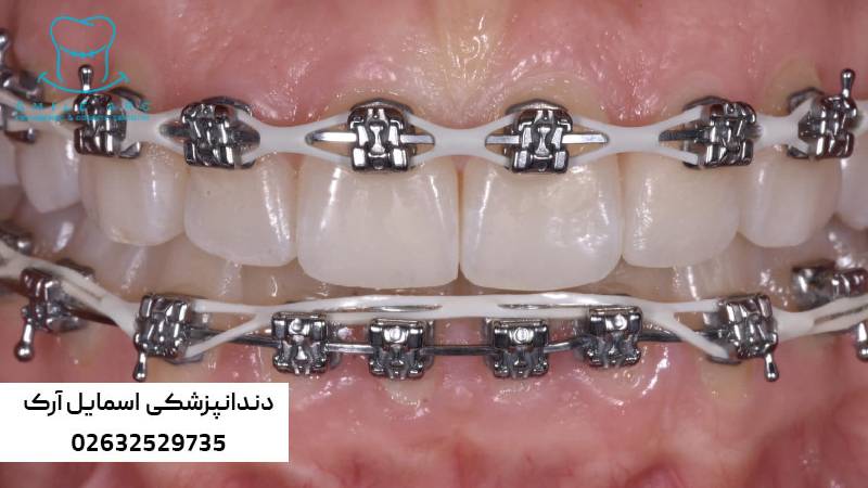 ارتودنسی ارزان در کرج