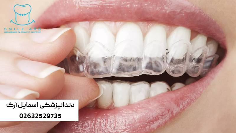 درد فک در ارتودنسی