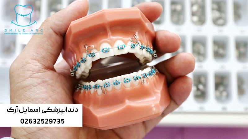 درد فک در ارتودنسی