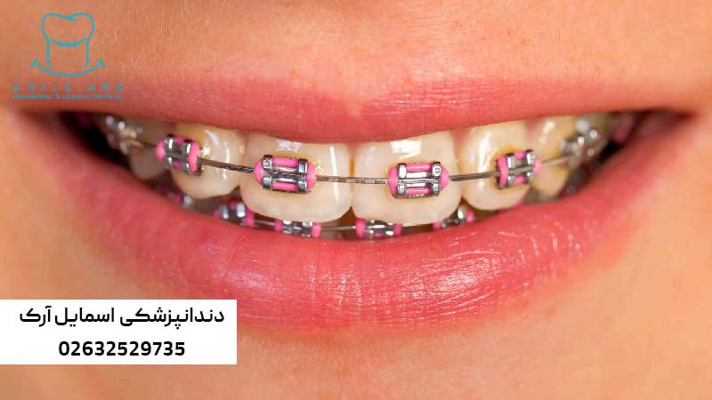 درد فک در ارتودنسی