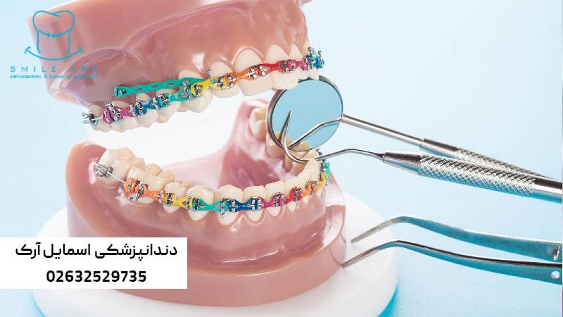 درد فک در ارتودنسی